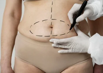 Abdominoplastia pode ir além da estética e melhorar a saúde e a qualidade de vida
