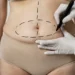 Abdominoplastia pode ir além da estética e melhorar a saúde e a qualidade de vida