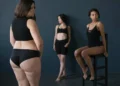 Cada vez mais brasileiras buscam soluções para tratar lipedema e linfedema